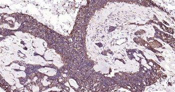 NFKB p65 Ready-To-Use IHC Kit