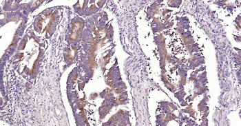 Human CRIM1 Ready-To-Use IHC Kit