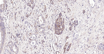 Human CRIM1 Ready-To-Use IHC Kit