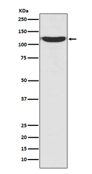 PKN2 Recombinant Rabbit Monoclonal Antibody