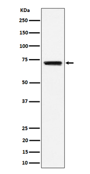 BLNK Recombinant Rabbit Monoclonal Antibody