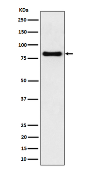 SCIN Recombinant Rabbit Monoclonal Antibody