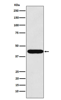 LHX2 Recombinant Rabbit Monoclonal Antibody