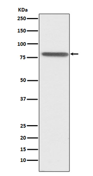 PSAP Recombinant Rabbit Monoclonal Antibody