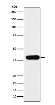 Adenosine deaminase Recombinant Rabbit Monoclonal Antibody