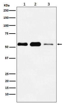 PNPLA2 Recombinant Rabbit Monoclonal Antibody