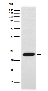 TNNI2 Recombinant Rabbit Monoclonal Antibody