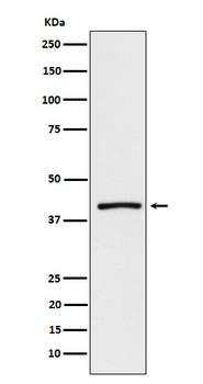 ATP1B3 Recombinant Rabbit Monoclonal Antibody