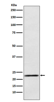 PRL Recombinant Rabbit Monoclonal Antibody