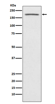 ACE Recombinant Rabbit Monoclonal Antibody