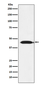 IDH2 Recombinant Rabbit Monoclonal Antibody