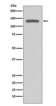 NOS2 Recombinant Rabbit Monoclonal Antibody