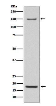 Integrin alpha 5 Recombinant Rabbit Monoclonal Antibody