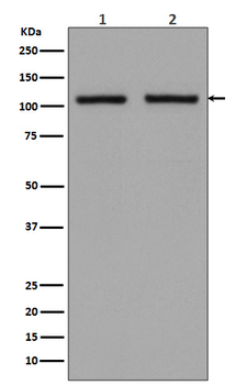 Hexokinase 1 Recombinant Rabbit Monoclonal Antibody