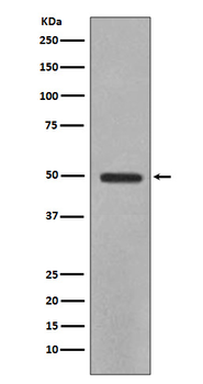 YB1 Recombinant Rabbit Monoclonal Antibody
