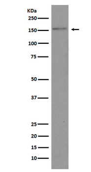 BRD4/CAP Recombinant Rabbit Monoclonal Antibody