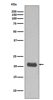 HRAS Recombinant Rabbit Monoclonal Antibody