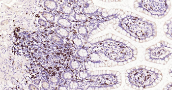 CD8 Recombinant Rabbit Monoclonal Antibody