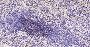 CD8 Recombinant Rabbit Monoclonal Antibody
