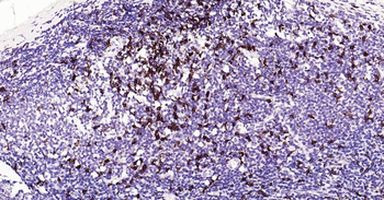 CD8 Recombinant Rabbit Monoclonal Antibody