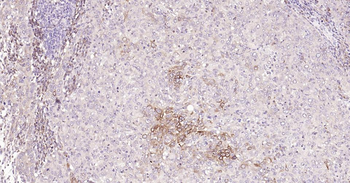 Bcl-2 Recombinant Rabbit Monoclonal Antibody