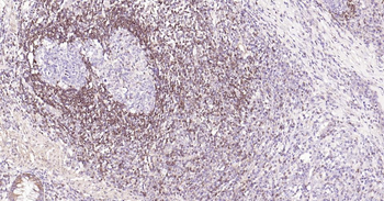 Bcl-2 Recombinant Rabbit Monoclonal Antibody