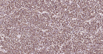 Bcl-2 Recombinant Rabbit Monoclonal Antibody