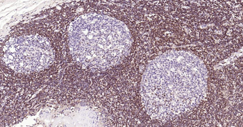 Bcl-2 Recombinant Rabbit Monoclonal Antibody