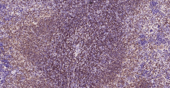Bcl-2 Recombinant Rabbit Monoclonal Antibody
