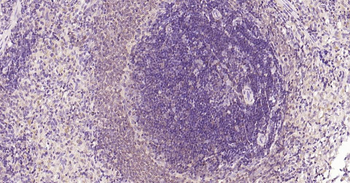Bcl-2 Recombinant Rabbit Monoclonal Antibody