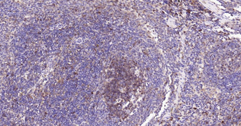 Caspase-3 Recombinant Rabbit Monoclonal Antibody
