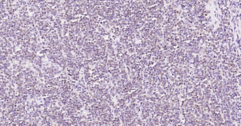 BOB1 Mouse Monoclonal Antibody