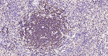 BOB1 Mouse Monoclonal Antibody