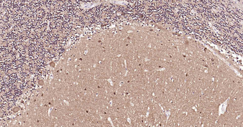 Tau-4 Mouse Monoclonal Antibody