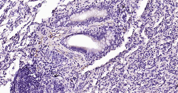 Tau-4 Mouse Monoclonal Antibody