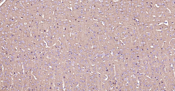Tau-4 Mouse Monoclonal Antibody
