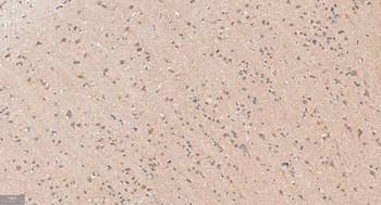 APPL1 Recombinant Rabbit Monoclonal Antibody