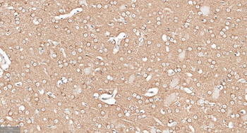 APPL1 Recombinant Rabbit Monoclonal Antibody