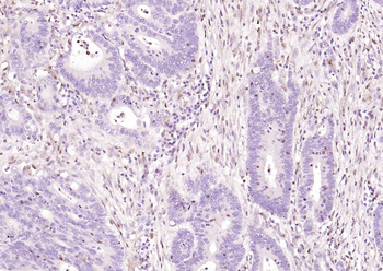 S100A4 Mouse Monoclonal Antibody