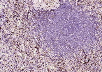 S100A4 Mouse Monoclonal Antibody