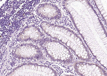 IL18 Recombinant Rabbit Monoclonal Antibody