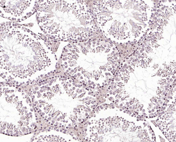 PLA2R Rabbit Polyclonal Antibody