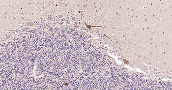 MAP2 Rabbit Polyclonal Antibody