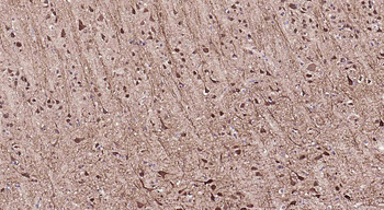 MAP2 Rabbit Polyclonal Antibody