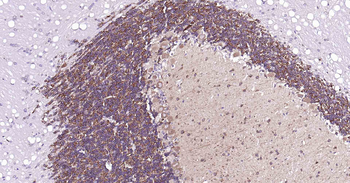 MAP2 Rabbit Polyclonal Antibody