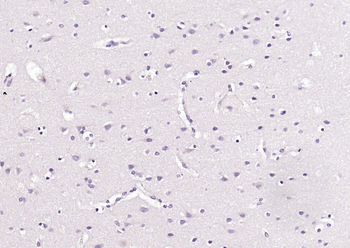 MYH1 Rabbit Polyclonal Antibody