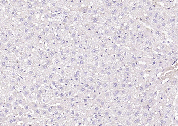 MYH1 Rabbit Polyclonal Antibody