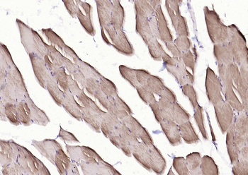 MYH1 Rabbit Polyclonal Antibody