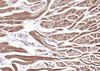 MYH1 Rabbit Polyclonal Antibody