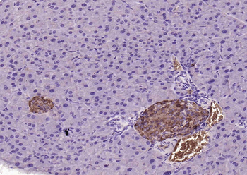 CHGA Rabbit Polyclonal Antibody